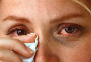 Причины и симптомы покраснение глаз