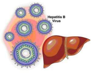 Лечение гепатита В в домашних условиях