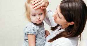 Симптомы и лечение краснухи у детей