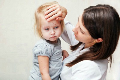 Лечение краснухи у детей