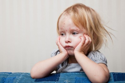Симптомы краснухи у детей